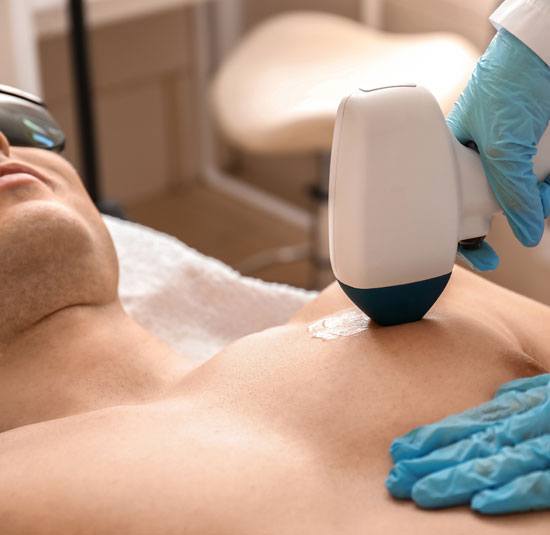 laser-hair-removal-men-img